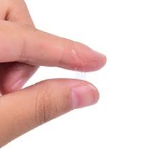 วิธีล้างกาวร้อนติดมือ